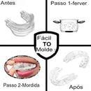 Protetor Bucal Ante Ronco e Bruxismo